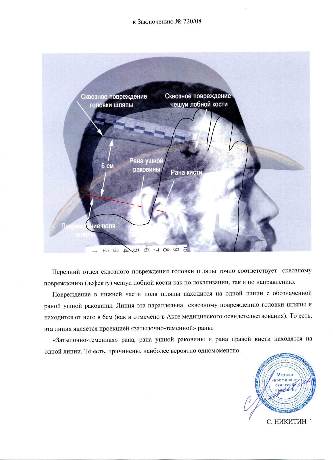 Схема совмещения повреждения черепа великого князя Николая Александровича. Фотография шляпы великого князя Николая Александровича к заключению экспертизы. 10 сентября 2008 г.
